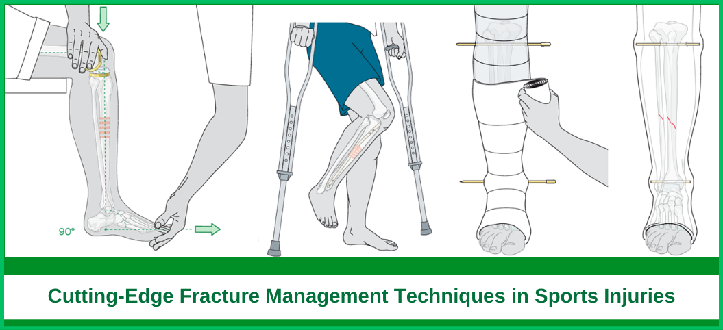 Cutting-Edge Fracture Management Techniques in Sports Injuries