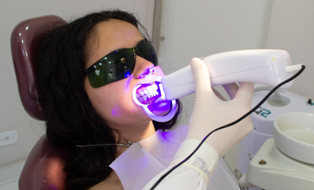 Tooth Whitening